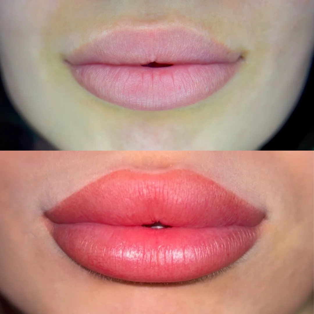 Lip Micropigmentation